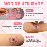 Plasturel® GLP-1 4